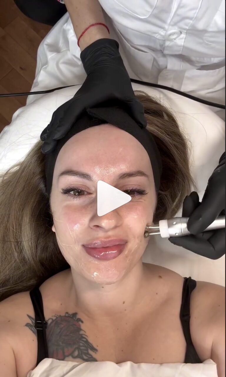 Cosmetology treatment filmed by Tati from LA for a clinic collaboration